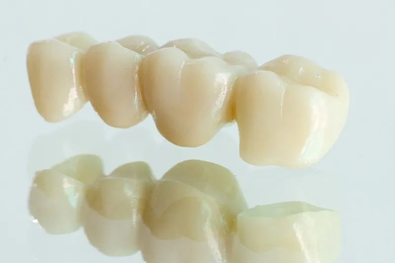 歯科用金属の害
